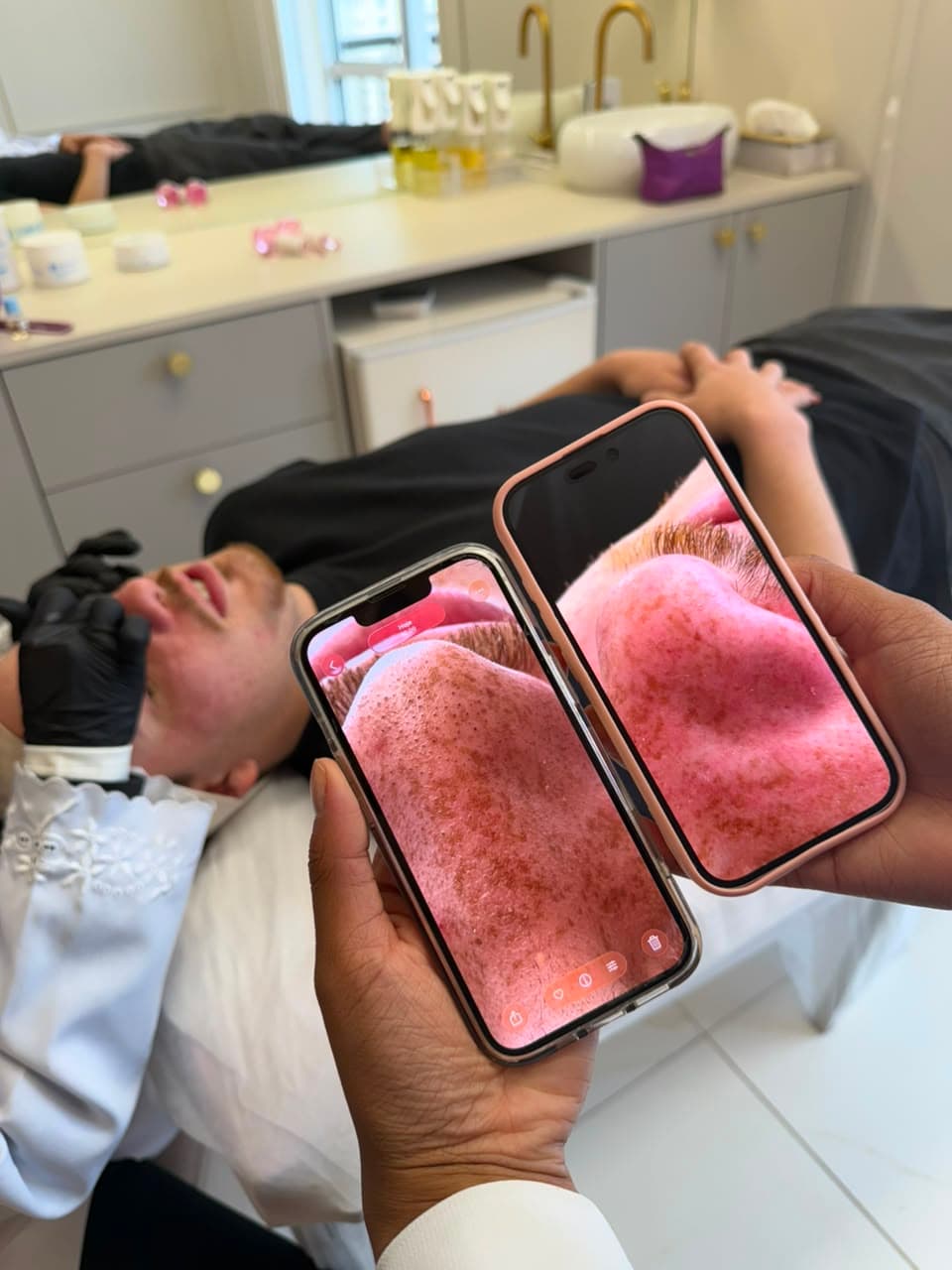 Aluna do SkinLab comparando, em duas telas de celular, o close da pele do paciente durante a avaliação.